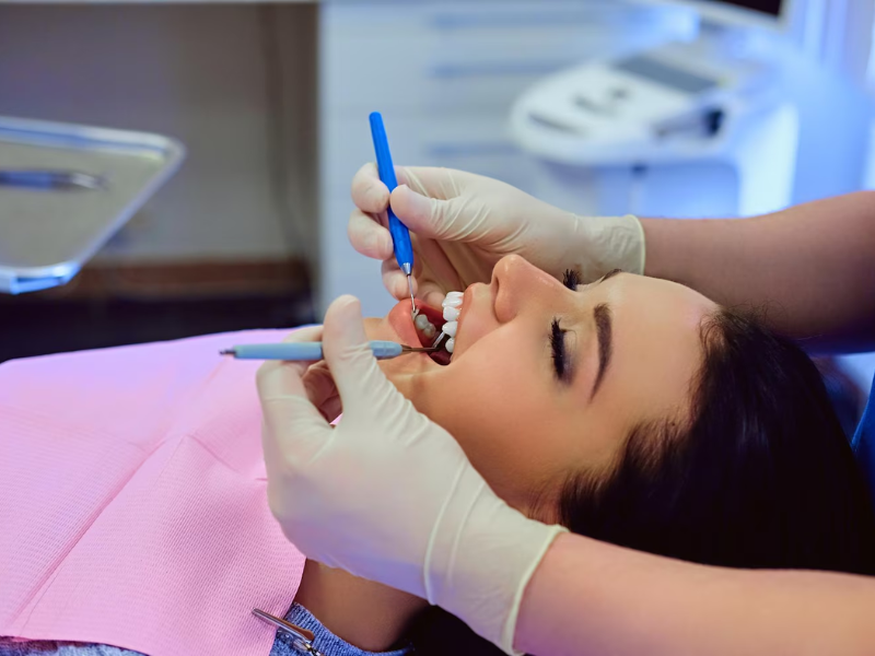 How to Keep Your Teeth White After Whitening Complete Maintenance Guide