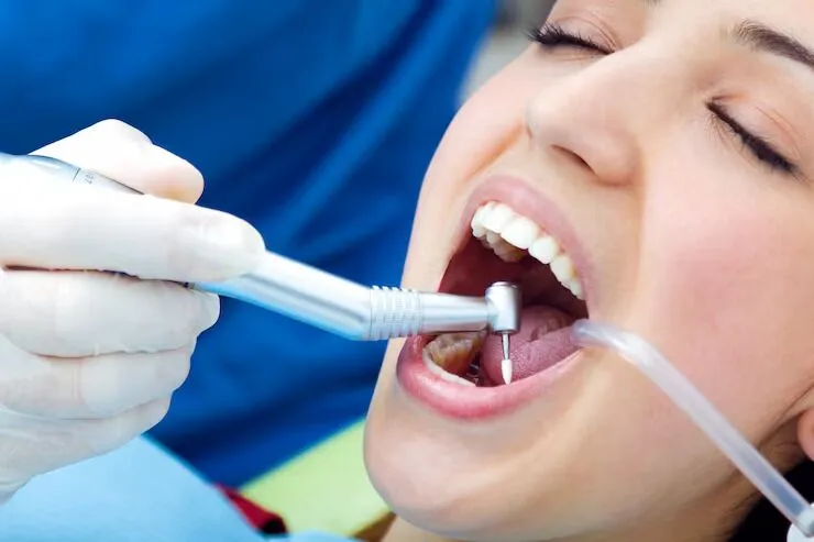  tooth extraction