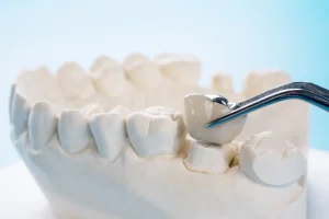 same day dental crown treatment